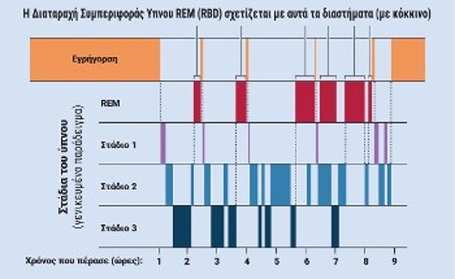 Οταν πέφτουμε να κοιμηθούμε, ο εγκέφαλος μεταπηδά μεταξύ μιας σειράς σταδίων, που διακρίνονται από χαρακτηριστική εγκεφαλική δραστηριότητα. Τα εγκεφαλικά κύματα στη φάση REM του ύπνου μοιάζουν με εκείνα της εγρήγορσης. Σε αυτή τη φάση μπορεί να εκδηλωθεί RBD, αν για κάποιο λόγο έχει ακυρωθεί η μυική παράλυση κατά τη διάρκεια του ύπνου