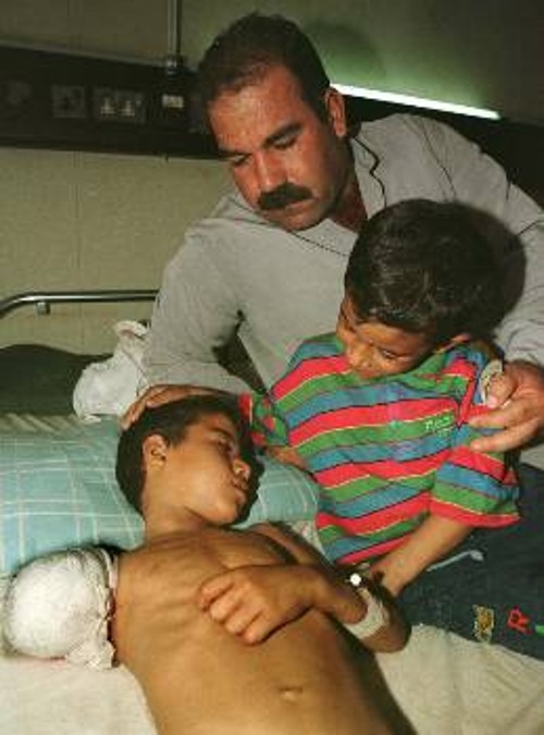 Μικρός Ιρακινός με κομμένο χέρι από τους αμερικανοβρετανικούς βομβαρδισμούς