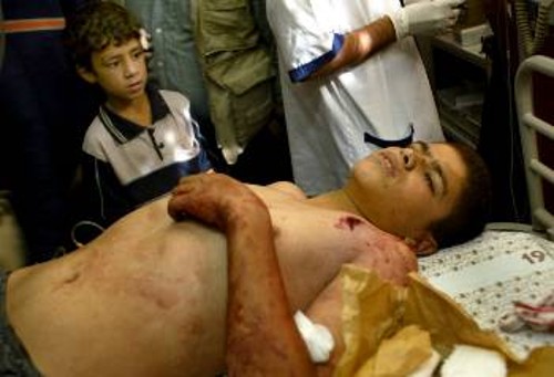 Δεκαεξάχρονος Παλαιστίνιος τραυματίας απο ισραηλινές σφαίρες