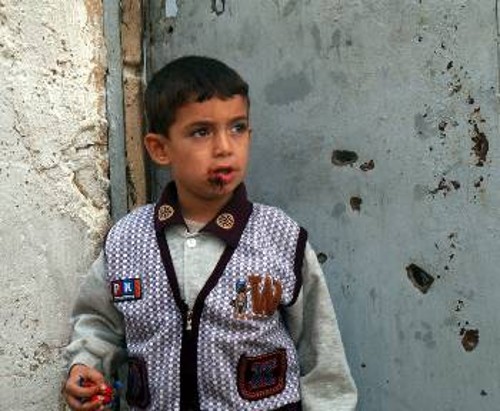 Ο μικρός Ιρακινός τραυματίστηκε από θραύσμα στις συγκρούσεις στη Σαμάρα