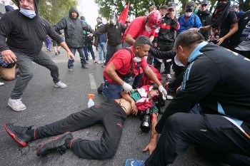 Ο χτυπημένος φωτορεπόρτερ που είναι σε κρίσιμη κατάσταση